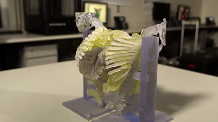 Modèle 3D d'un thorax de sœurs siamoises